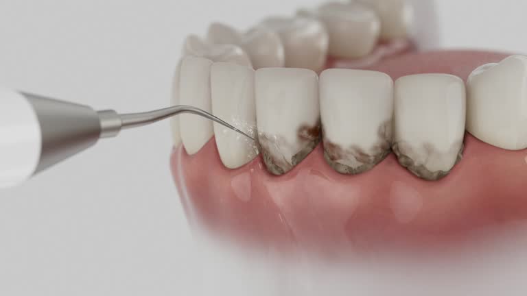 Trusted Wisdom Tooth Removal service in West Memphis, AR - Dentist Open Now